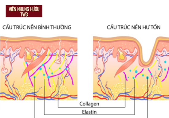Kết cấu collagen và elastin lỏng lẻo hơn là dấu hiệu da đang dần lão hóa