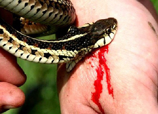 Nọc độc của rắn làm giảm thời gian sống của hồng cầu