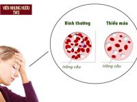[Cảnh báo] 10 Nguyên nhân gây thiếu máu bạn KHÔNG ngờ tới