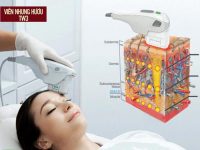 6 Cách trị da lão hóa hiệu quả cho làn da luôn tươi trẻ