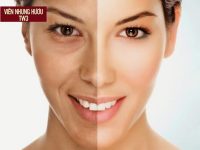 Lão hóa da là gì? Nhận biết và trẻ hóa da lão hóa