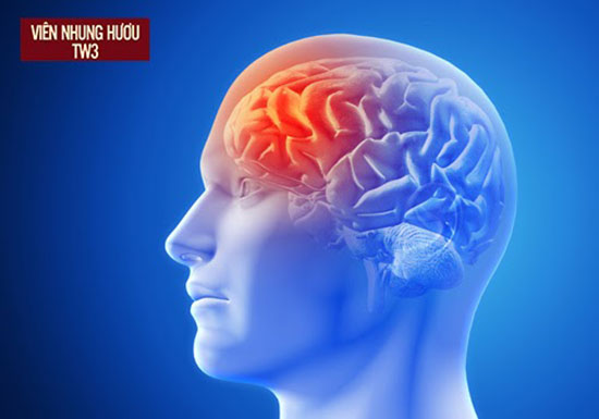 Thiếu máu não là hiện tượng giảm tuần hoàn máu lên não